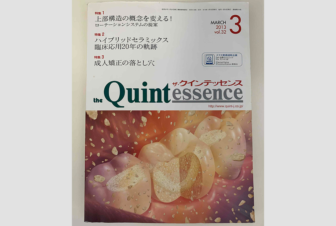 The Quintessence. Vol.32 No.3(クインテッセンス出版株式会社)(2013年)
