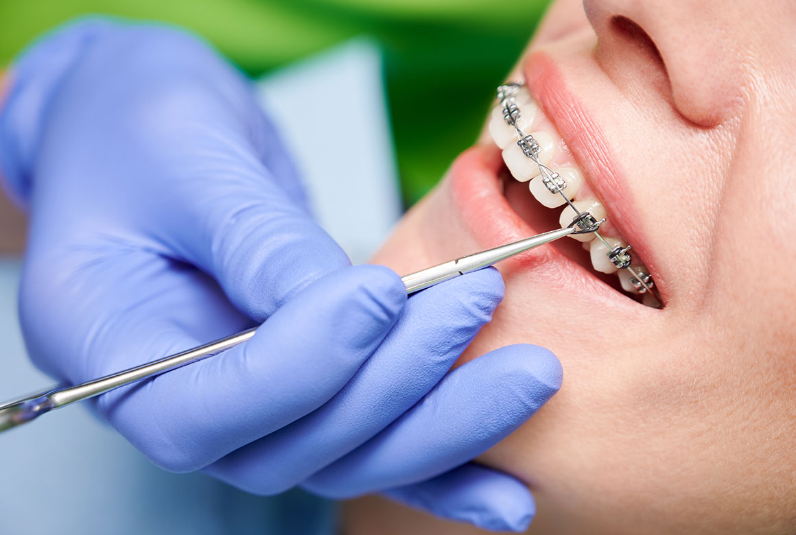 日本矯正歯科学会認定の専門医が治療を行います