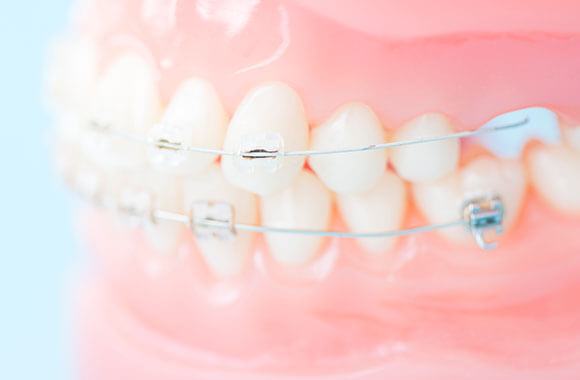 歯並び・噛み合わせを改善する矯正歯科